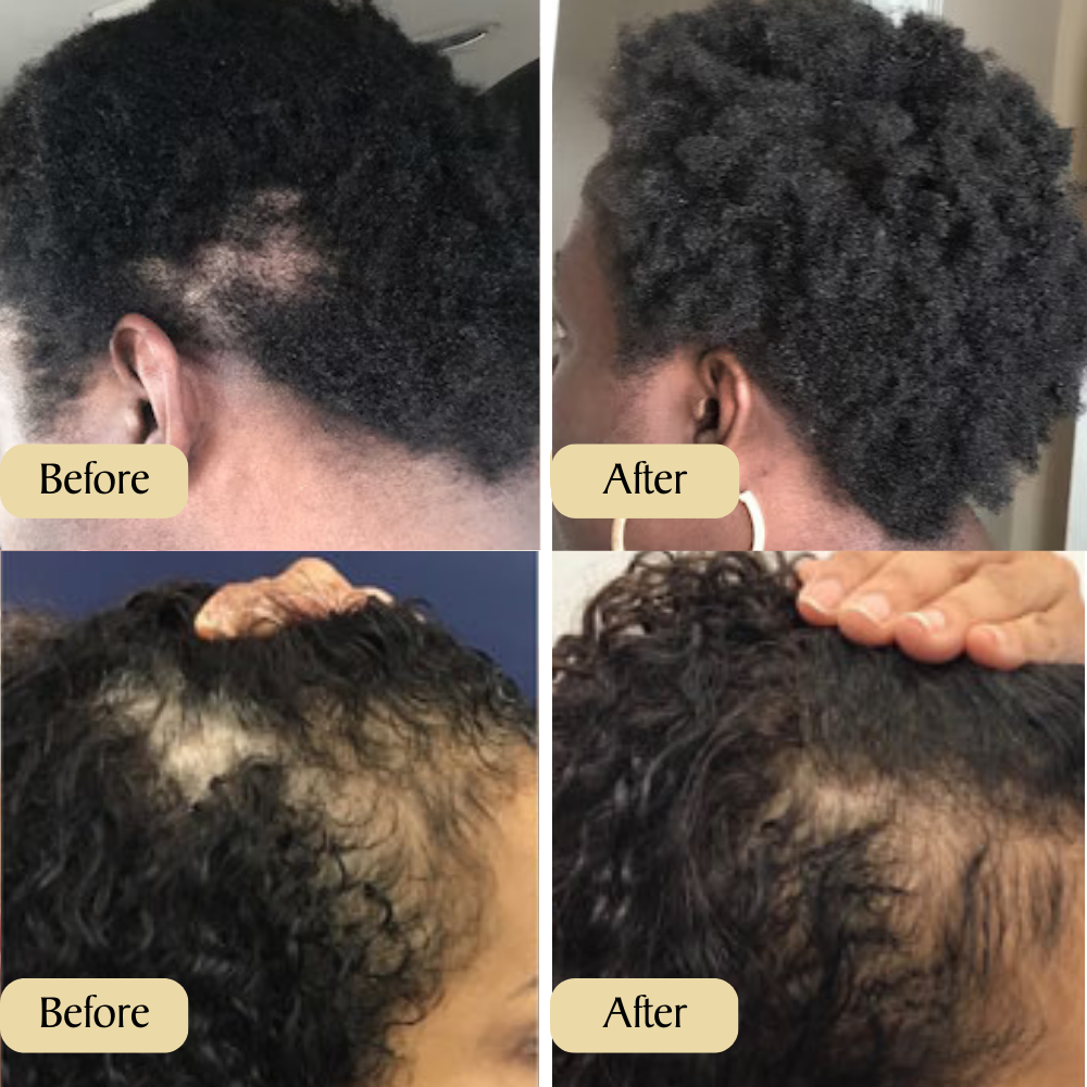 Veganic Hair Oil (OFFER FOR BUYING 3)